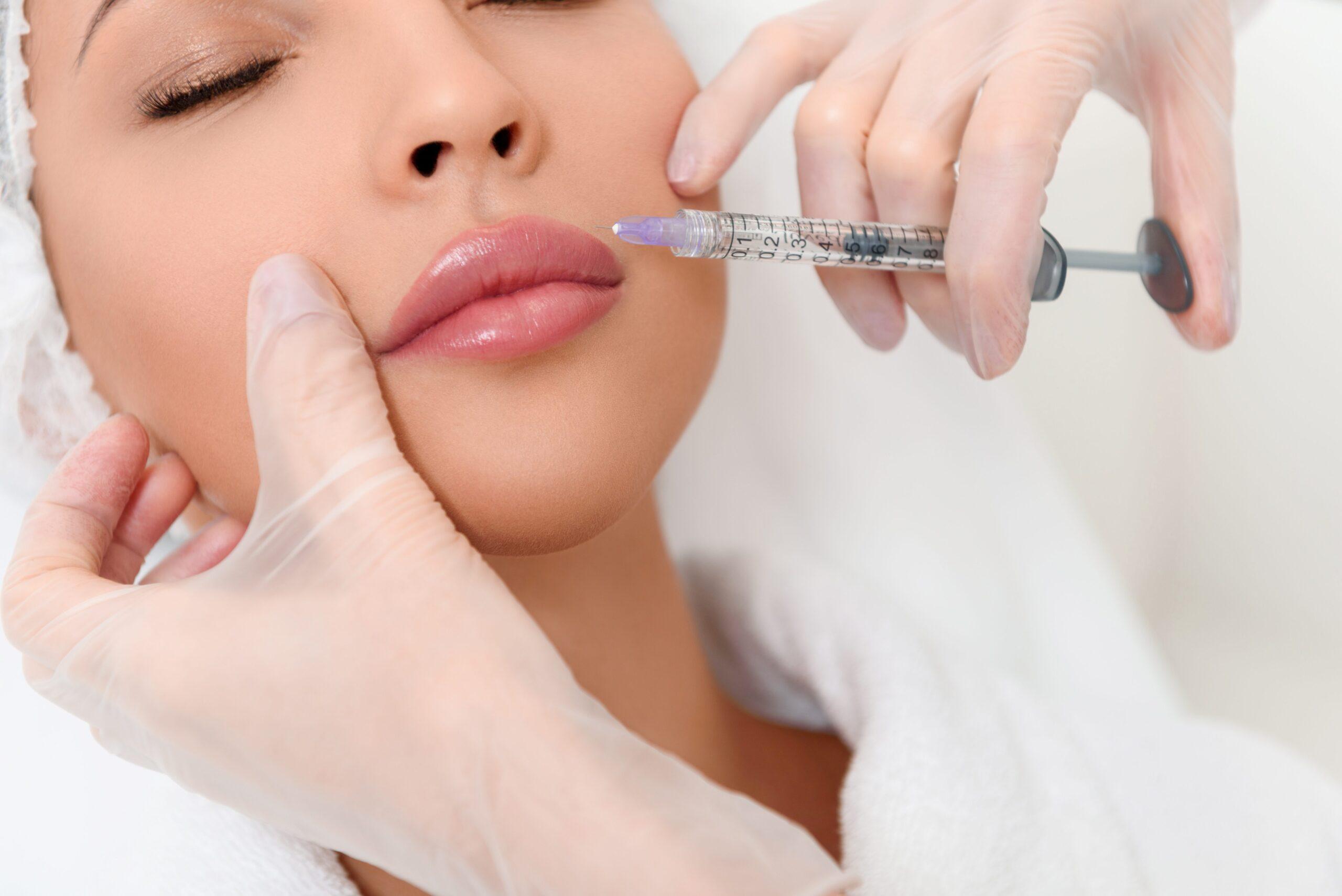 Russian Lips Technik_Volle Lippen